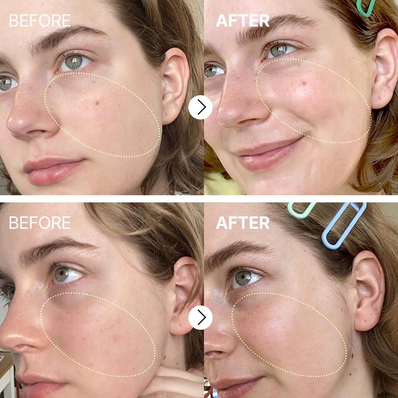 سرم ویتامین C کوزارکس