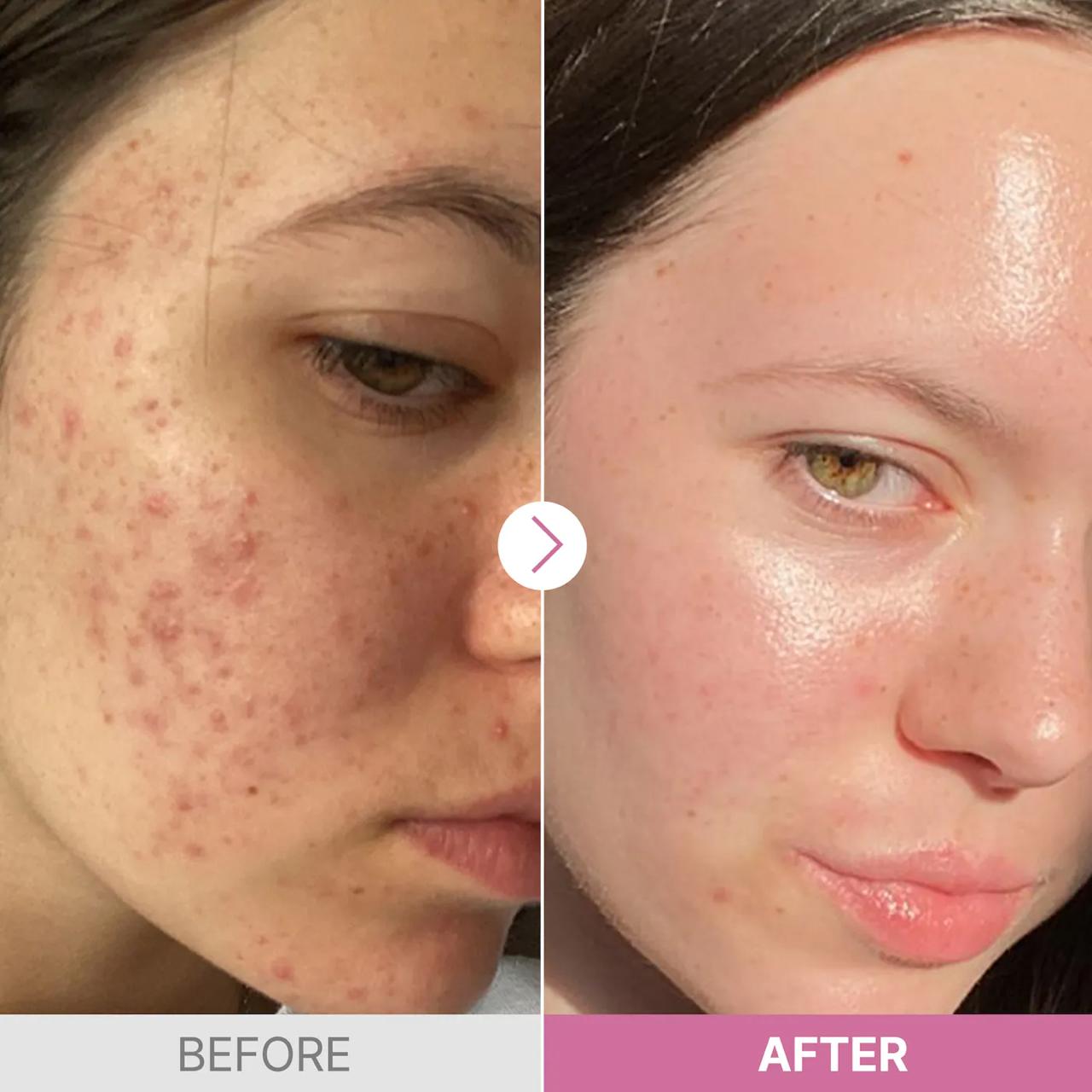 سرم نیاسینامید 15 درصد کوزارکس